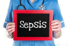 Sepsis