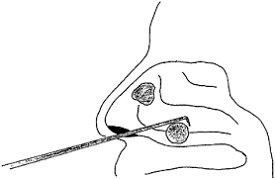 Nasal